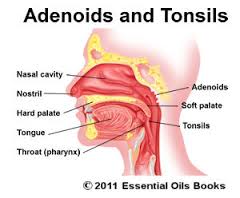adenoid