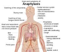 anaphylactic
